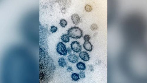 Hình ảnh kính hiển vi điện tử của SARS-CoV-2 trong một bệnh nhân ở Mỹ. Ảnh: NIAID-RML.