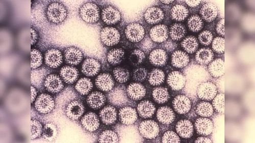 Rotavirus là tác nhân khiến nhiều trẻ em tử vong vì tiêu chảy. Ảnh: CDC.