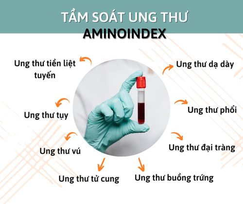 Công nghệ AminoIndex giúp tầm soát sớm nguy cơ mắc nhiều loại ung thư