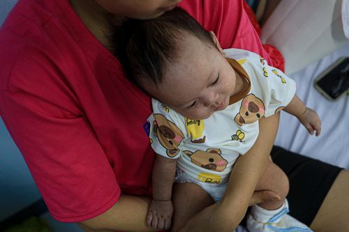  Bác sĩ chuyên khoa II Dư Tuấn Quy, Trưởng khoa Nhiễm - Thần kinh, Bệnh viện Nhi đồng 1 cho biết số ca nhập viện do mắc bệnh sởi tại khoa đang tăng mạnh. Ngày 13/8, đơn vị này đang điều trị nội trú cho 39 ca mắc bệnh sởi. Ngày cao điểm, số lượng bệnh nhân điều trị nội trú tại khoa lên đến 50 ca, gần như gấp đôi so với trước đây. Trong đó, một số bệnh nhi gặp biến chứng, thường gặp nhất là viêm phổi. 