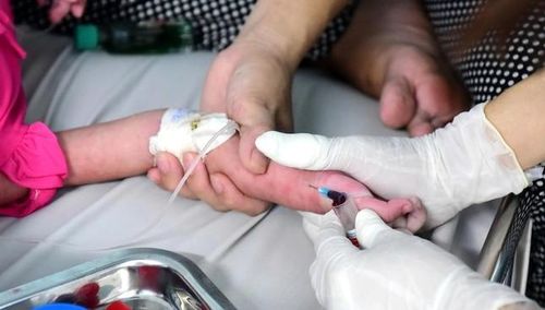 Trẻ điều trị sởi tại Bệnh viện Nhi đồng 1 TP.HCM - Ảnh: Duyên Phan