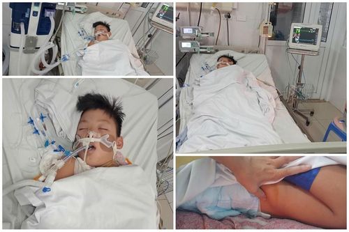  Cháu Huy được chẩn đoán viêm não virus không xác định, đột quỵ chưa rõ do xuất huyết hay nhồi máu. Để cầm cự sự sống cho em phải mất hàng chục triệu mỗi ngày. 