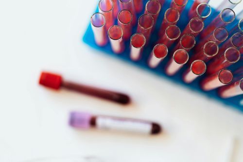  Hiểu rõ sự khác biệt giữa cholesterol “tốt” và “xấu” giúp bạn điều chỉnh ăn uống, vận động để bảo vệ tim mạch. Ảnh: Pexels. 