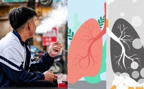 Việc hoàn thiện khung pháp lý theo hướng toàn diện, đồng bộ sẽ góp phần bảo vệ sức khỏe người dân, đặc biệt là thế hệ trẻ, đồng thời hướng tới mục tiêu xây dựng môi trường sống không khói thuốc trong tương lai.