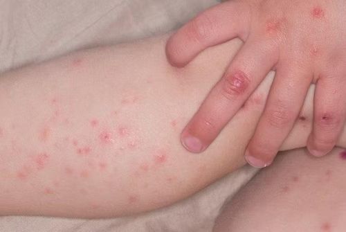 Ảnh minh họa/Internet