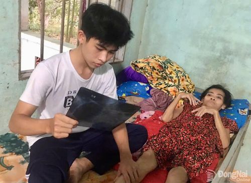 Bà Hoa từng là trụ cột gia đình, đi trút mủ cao su thuê để nuôi con, nhưng giờ đây đến cả việc ăn uống, sinh hoạt cũng phải cậy nhờ con trai út và sự giúp đỡ của xóm giềng. Ảnh: Thu Hiền