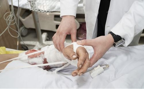 Tay của bệnh nhân sau phẫu thuật bước đầu phục hồi khả quan, tiếp tục theo dõi, điều trị, phục hồi chức năng. Ảnh: HL