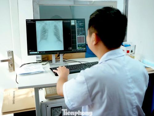 Bác sĩ CKII Nguyễn Thanh Hải - Giám đốc Bệnh viện Phổi Nghệ An chia sẻ: Hoạt động khám bệnh, tư vấn sức khỏe miễn phí không chỉ giúp người dân tiếp cận dịch vụ y tế ngay tại cơ sở mà còn góp phần nâng cao nhận thức về việc chủ động phòng bệnh, phát hiện sớm và điều trị kịp thời.