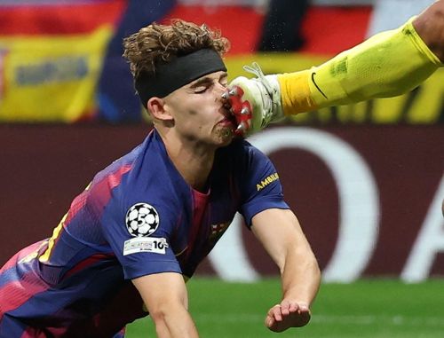  VAR giải thích: "Fermin dứt điểm trong tư thế bay người và va chạm với giày của Musso khi tiếp đất, ở độ cao hoàn toàn bình thường. Đây được xem là pha tranh chấp hợp lệ nên VAR không can thiệp". 