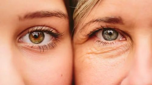 Nhóm nghiên cứu giải thích thêm rằng, một số gene như TYR và TYRP1 có thể thúc đẩy quá trình tạo sắc tố, khiến mắt có sẫm màu hơn dự kiến. Trong khi đó, các gene khác như IRF4 lại có thể làm giảm hoạt động này khiến màu mắt trở nên sáng hơn. Ảnh: Ảnh: Wundervisuals/Getty Images.