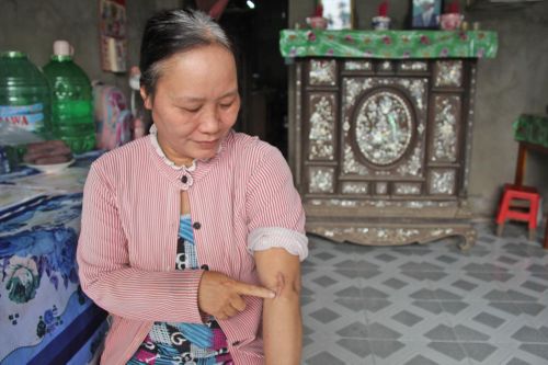 Ảnh hưởng di chứng sau vụ tai nạn, sức khỏe chị Lệ giảm sút.