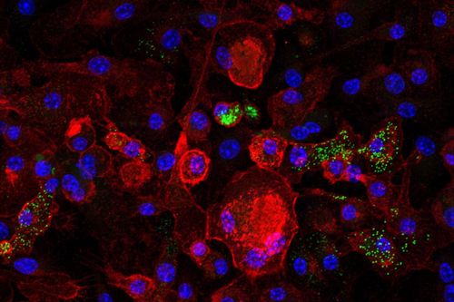 Hình ảnh hiển vi cho thấy các đại thực bào lão hóa màu đỏ và các giọt lipid chứa cholesterol – yếu tố chính gây ra sự lão hóa – màu xanh lục. Nguồn ảnh: Lizeth Estrada, Phòng thí nghiệm Covarrubias.