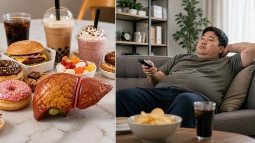 Đồ ngọt và lối sống ít vận động là nguyên nhân phổ biến gây tích mỡ trong gan