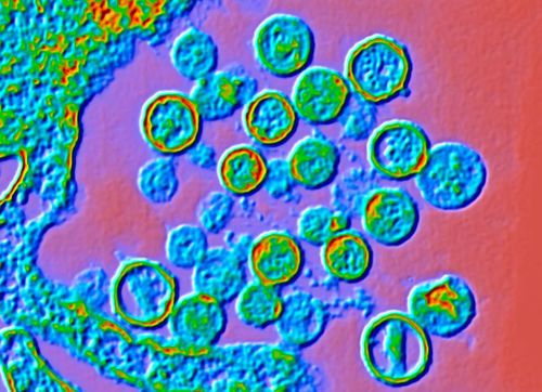 Các virus Hantavirus trong hình ảnh dưới kính hiển vi. Ảnh: Science Photo Library