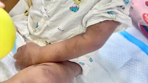 Những vết thương trên người bé K.