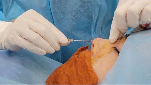  Bác sĩ thực hiện một ca thẩm mỹ cho khách hàng. 
