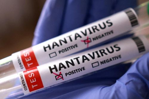  Andes là chủng virus duy nhất thuộc họ Hanta có khả năng lây nhiễm từ người sang người, nhưng khả năng lây nhiễm thấp. Ảnh: ICP. 