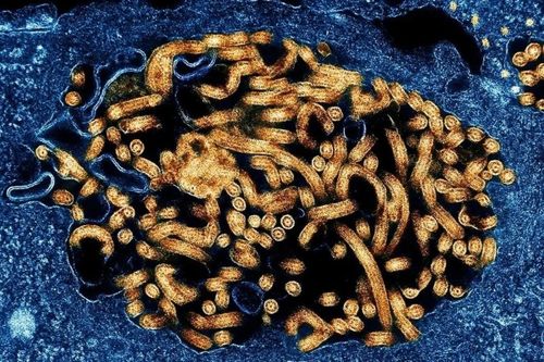  Virus Ebola lây truyền giữa người với người không qua đường không khí như cúm hay Covid-19 mà xảy ra thông qua tiếp xúc trực tiếp với dịch cơ thể. Ảnh: NIH/NIAID/BSIP. 