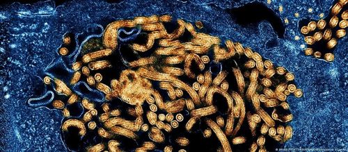 Ebola, được cho là có nguồn gốc từ loài dơi, có thể gây xuất huyết nghiêm trọng và suy đa cơ quan. Ảnh: Mage Point FR