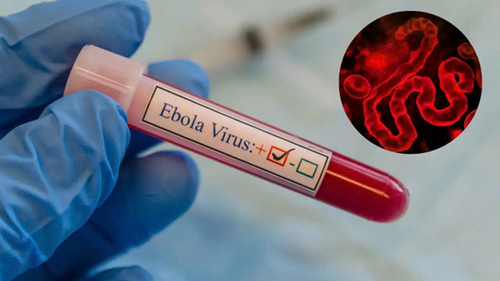 TP Hồ Chí Minh tăng cường giám sát ngăn virus Ebola xâm nhập. Ảnh: SYT