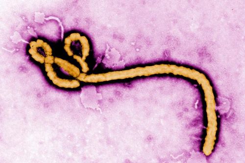 Virus Ebola dưới ống kính hiển vi. Ảnh: SCMP.