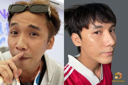 Lê Chí Nguyện mong muốn thay đổi để có ngoại hifh thiện cảm hơn khi hoạt động nghệ thuật.