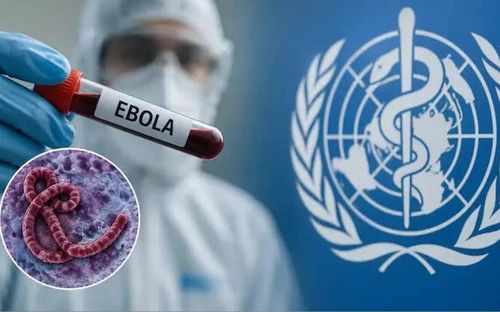 Bộ Y tế cập nhật dấu hiệu nhận biết bị nhiễm vi rút Ebola. Ảnh minh họa.