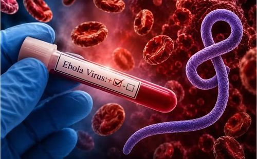 Virus Ebola hiện chưa có vắc xin hoặc thuốc điều trị đặc hiệu - Ảnh minh họa nguồn Internet