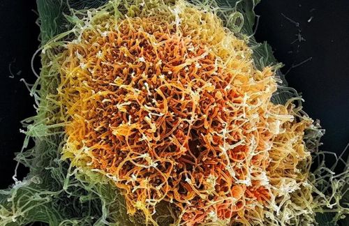 Ảnh hiển vi của các hạt virus Ebola. Có sáu loài virus giống Ebola đã được biết đến. Ảnh: Science Source