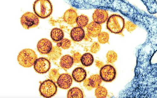 Ảnh hiển vi của một loại hantavirus được gọi là virus Sin Nombre, loại virus đã gây ra dịch bệnh ở phương Tây vào năm 1993. Ảnh: Science Source