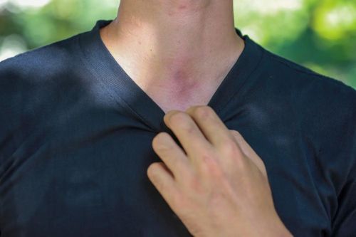  Vết chai tại yết hầu là quá trình của những tháng ngày khổ luyện của Thiếu úy Lê Văn Thịnh. 