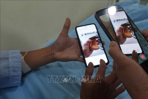 Nấm gan bò, một loại nấm được người dân địa phương tại Đà Lạt hay thu hái về dùng làm thực phẩm trong mùa mưa hàng năm.