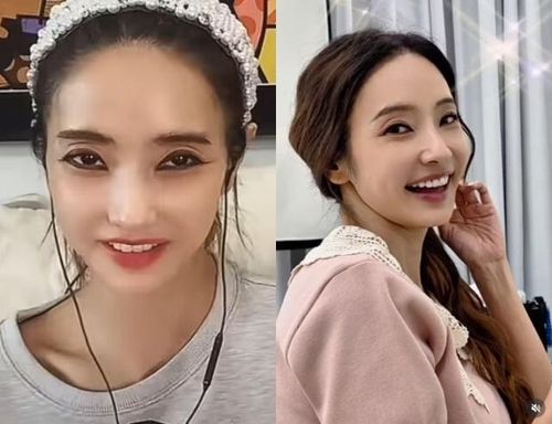 Vẻ ngoài của nữ diễn viên bị nhận xét có nhiều thay đổi so với trước. 