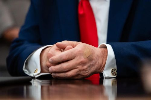  Vết băng bó trên bàn tay trái của ông Trump trong một cuộc họp tại Phòng Bầu dục hôm 11/6 được Nhà Trắng lý giải là do bắt tay thường xuyên. 