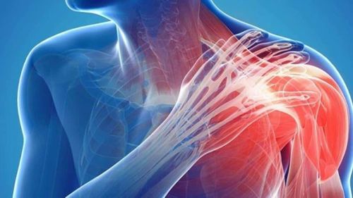 Các bệnh lý cơ xương khớp tạo ra áp lực rất lớn cho hệ thống y tế.