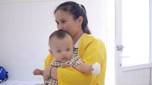 Bệnh nhi bị bỏng hơi nồi cơm.
