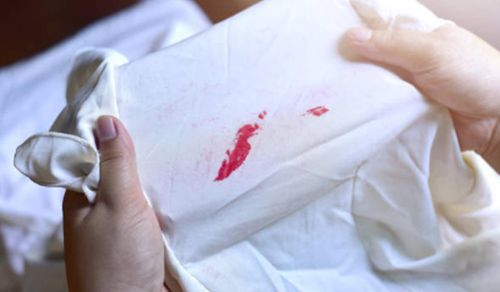 Đối với các vết bẩn cứng đầu như máu, cà phê, mỹ phẩm hoặc dầu mỡ, nên xử lý sơ bộ trước khi giặt. (Ảnh: iStock)