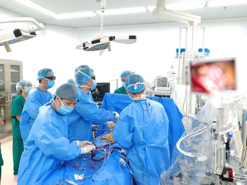 Tuần hoàn ngoài cơ thể vá tim cho bệnh nhân - Ảnh BVCC