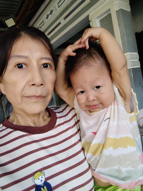 Chị Như đau lòng khi trên cơ thể con gái xuất hiện tình trạng da nhăn nheo. Ảnh: Nhân vật cung cấp.