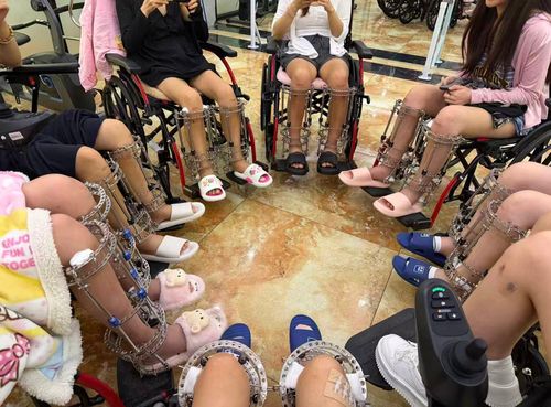 Bất chấp lệnh cấm phẫu thuật kéo dài chân vì mục đích thẩm mỹ, nhiều đường dây vẫn âm thầm hoạt động tại Trung Quốc và một số nước Đông Nam Á. Ảnh minh họa: Jieman News.