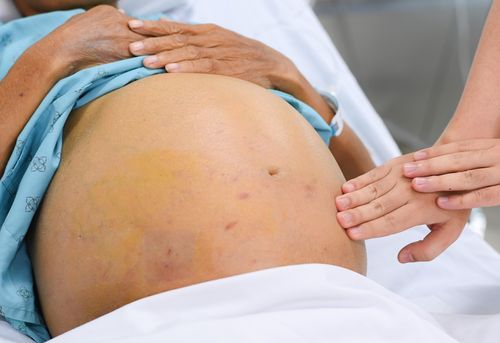 Theo bác sĩ, phía sau nhiều ca bệnh là những thói quen tưởng vô hại nhưng kéo dài nhiều năm. Ảnh minh họa: Việt Linh.
