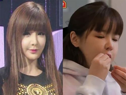 Park Bom từng vướng nghi vấn phẫu thuật thẩm mỹ khi ngoại hình thay đổi đáng kể so với thời còn hoạt động cùng 2NE1.