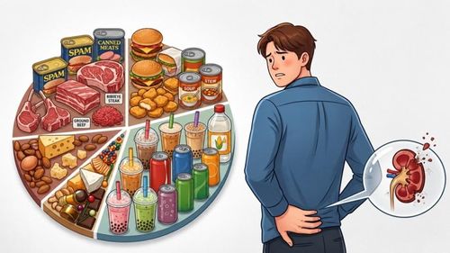  Thói quen ăn uống không khoa học là một trong những nguyên nhân chủ yếu dẫn đến bệnh sỏi thận. 