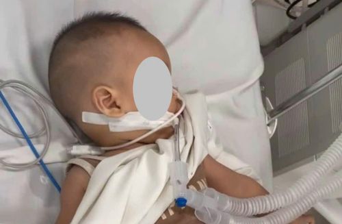 Bệnh nhi đang được cấp cứu. Ảnh: BVCC.