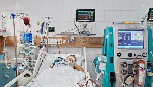 Người bệnh phải thở máy, lọc máu liên tục. Ảnh: BVCC