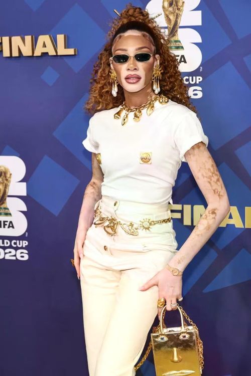 Người mẫu Winnie Harlow. Ảnh: Getty Images