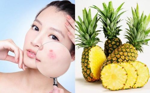 Đối với những người có làn da nhạy cảm tránh dùng dứa để chăm sóc da. Vì có thể gây dị ứng, nếu muốn sử dụng nên thoa một lượng nhỏ lên da tay để kiểm tra tác dụng phụ trước khi dùng cho mặt.