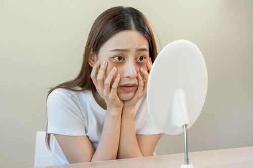  Vùng da quanh mắt vẫn sẫm màu, có xu hướng xanh tím hoặc đen và kéo dài trong nhiều tuần có thể cảnh báo gan có vấn đề. Ảnh: Shutterstock. 