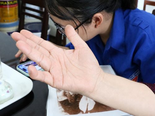 Những vết thương còn hằn trên bàn tay, ngón tay út chẳng thể nào duỗi thẳng là minh chứng cho những năm tháng chiến đấu kiên cường của nữ Anh hùng Hồ Thị Kim Thanh.