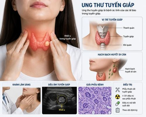 Không phải tất cả các trường hợp sau mổ ung thư tuyến giáp đều cần điều trị I-131. Ảnh do AI tạo.
